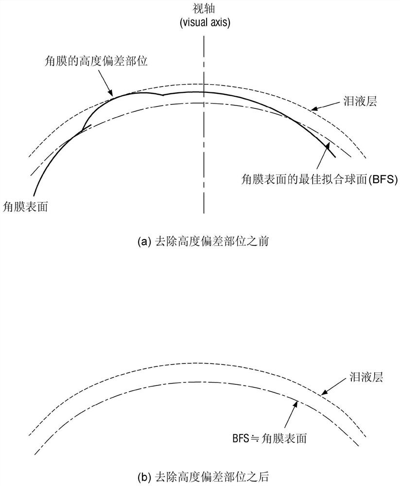 Laser corneal cutting system and method for treating xerophthalmia