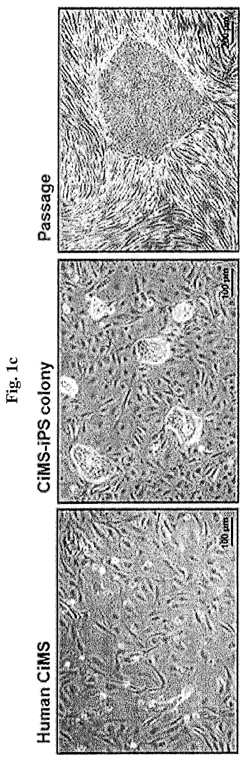 Method for differentiating induced pluripotent stem cells, which are prepared from endocardium-derived adult stem cells, into cardiovascular cells, and use thereof