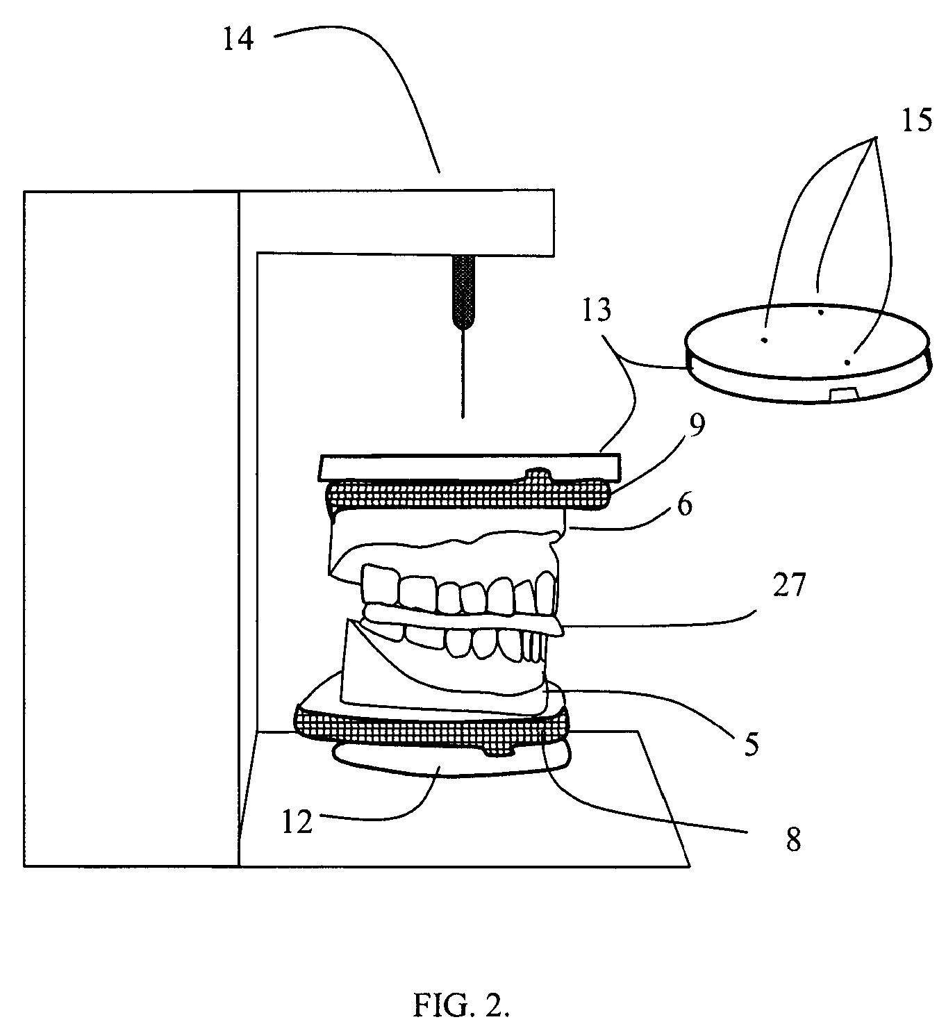 Surgical guides and methods for positioning artificial teeth and dental implants