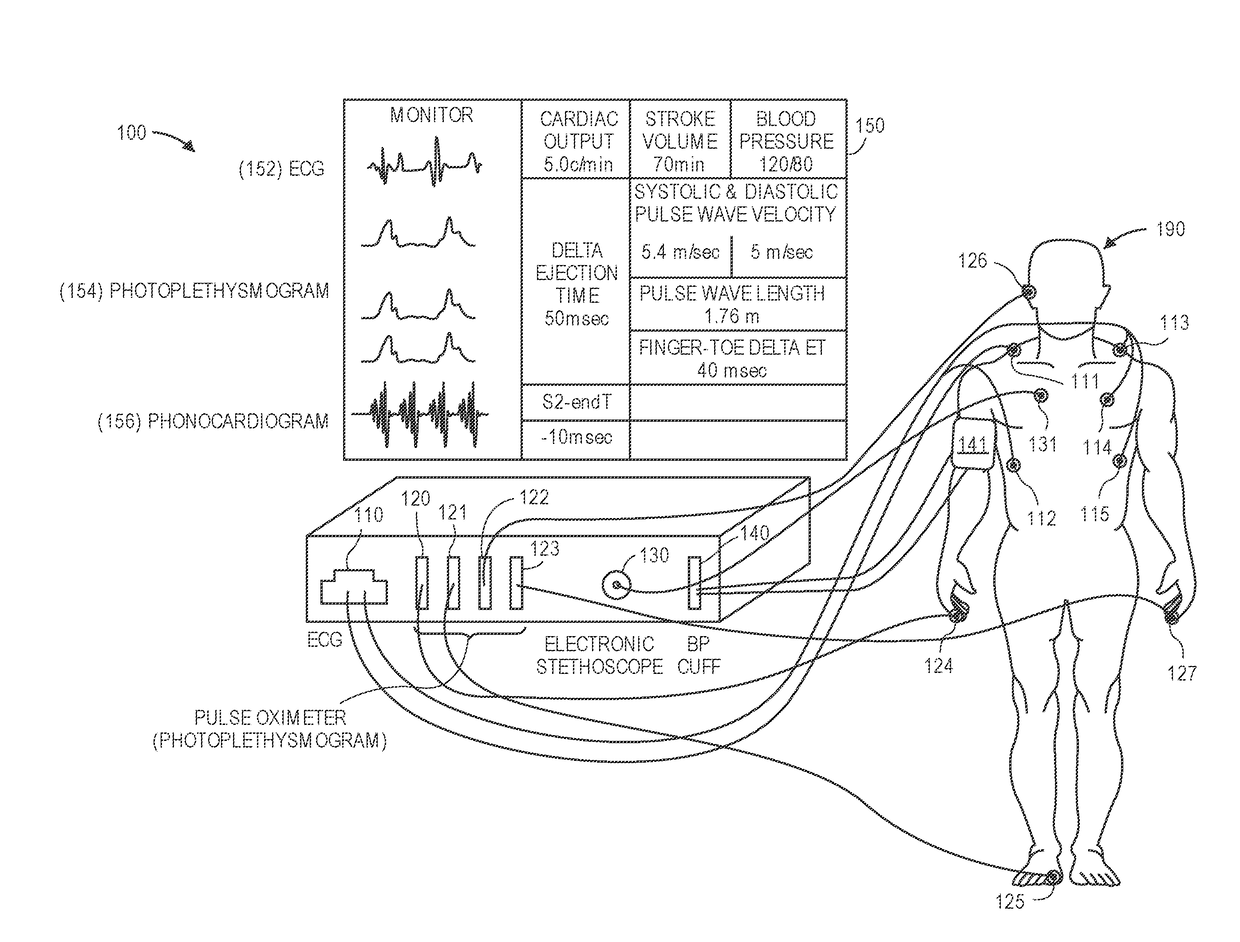 Novel device and method to measure ventricular arterial coupling and vascular performance