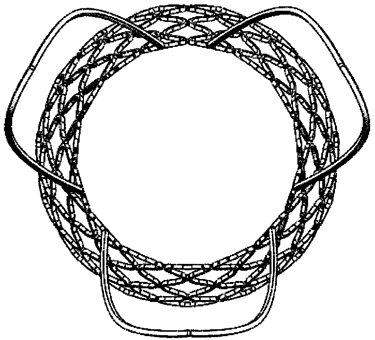 Self-expansion intervention valve stent for preventing coronary artery from being shielded