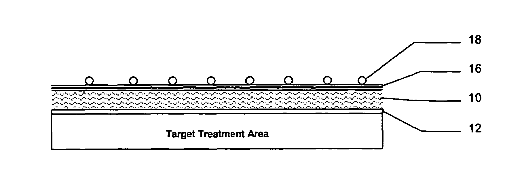 Apparatus for hyperthermia and brachytherapy delivery