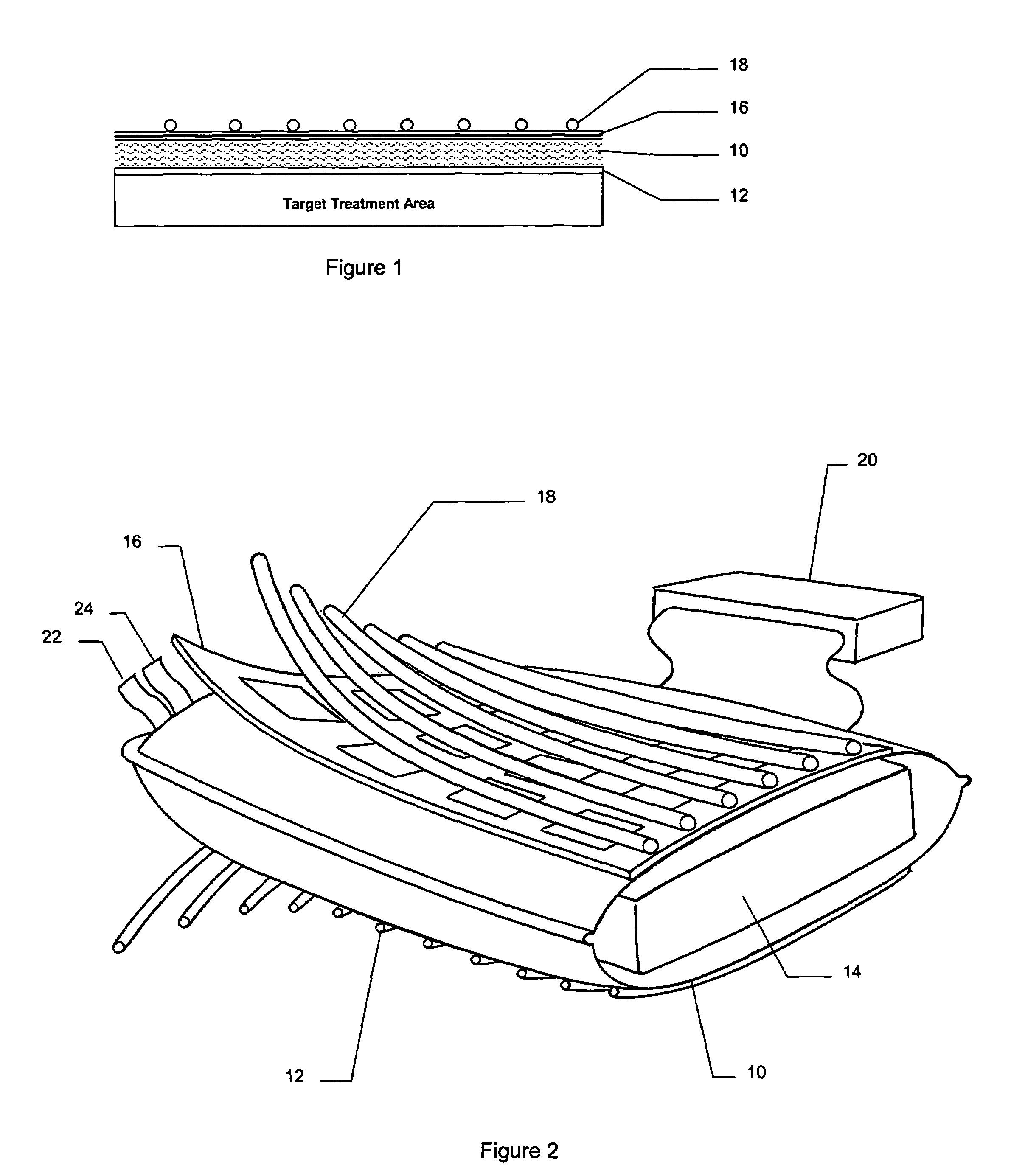 Apparatus for hyperthermia and brachytherapy delivery