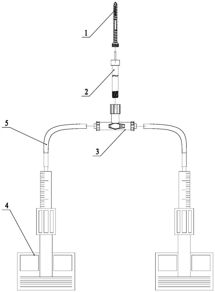 Injectable screw fixation system for femoral neck fractures