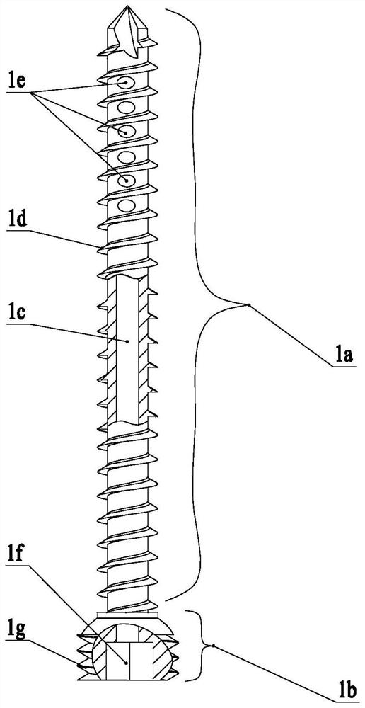 Injectable screw fixation system for femoral neck fractures