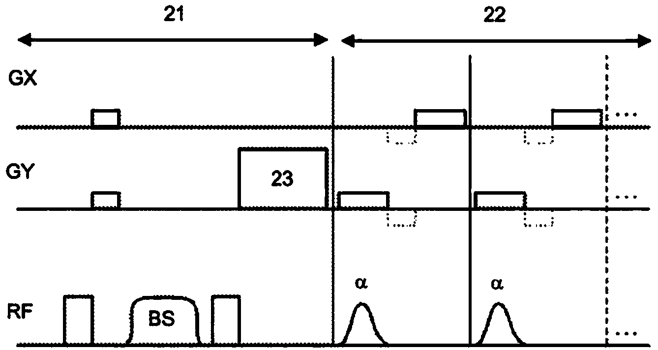 Mr imaging with b1mapping