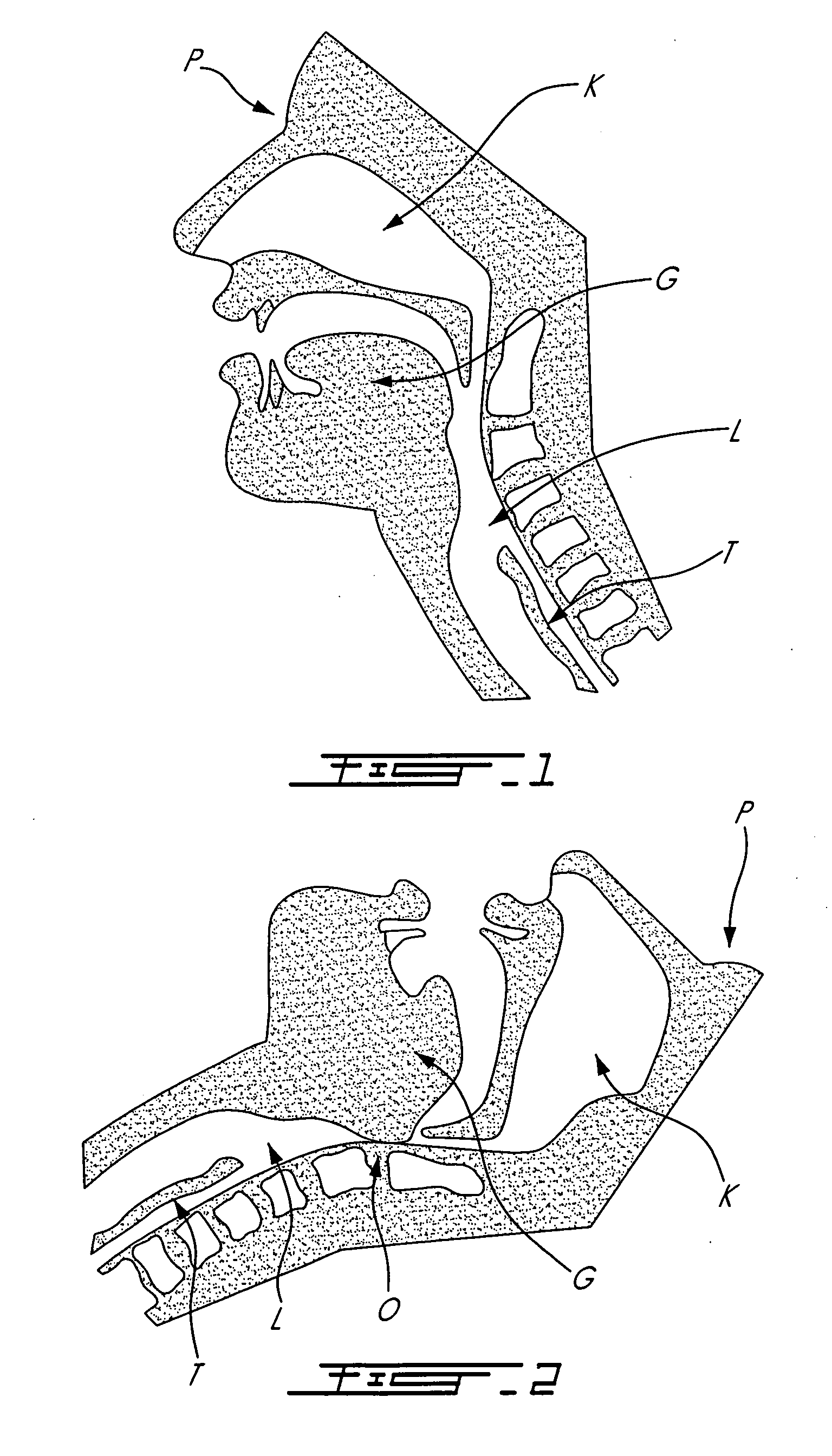 Respiratory apparatus with mouthpiece