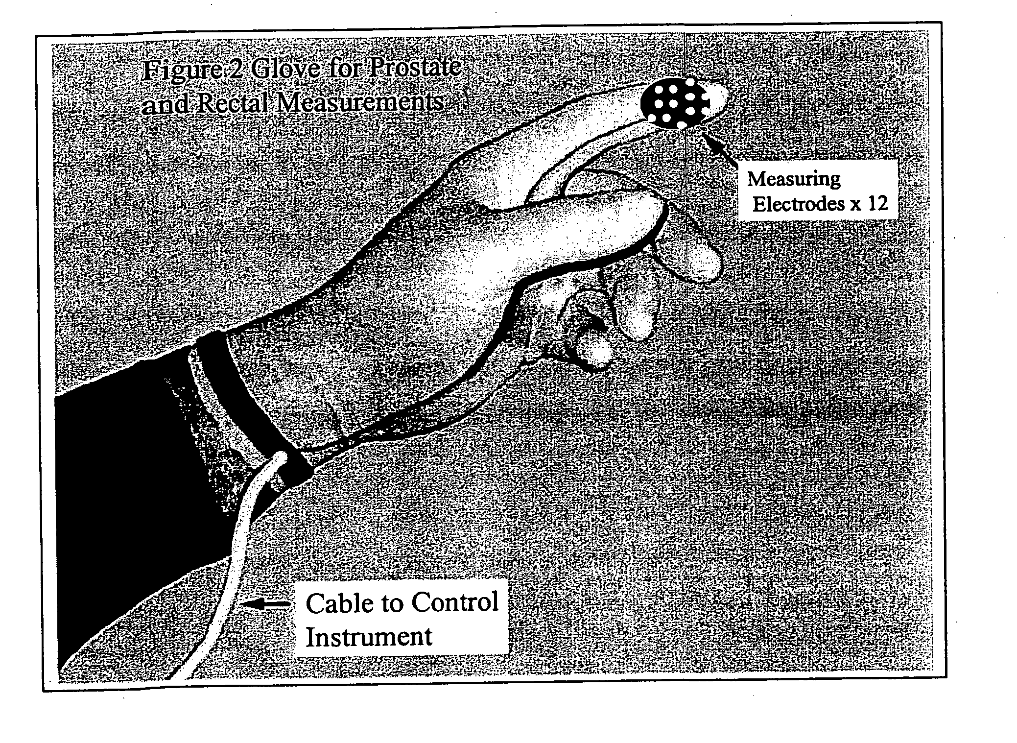 Method and system for detecting electrophysiological changes in pre-cancerous and cancerous tissue