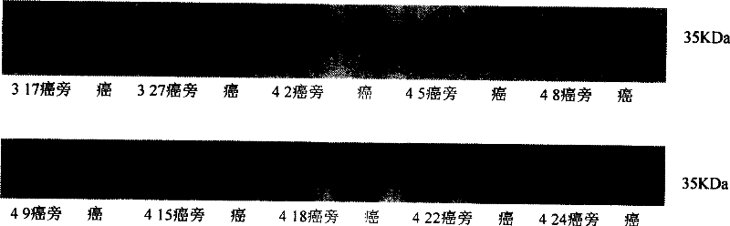 Application of 26S prolease regulatory subunit gene 1(non ATP enzyne)