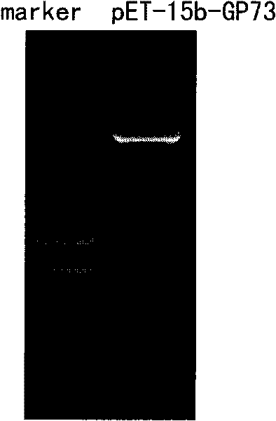 Monoclonal antibody against GP73 protein, preparation method and application thereof