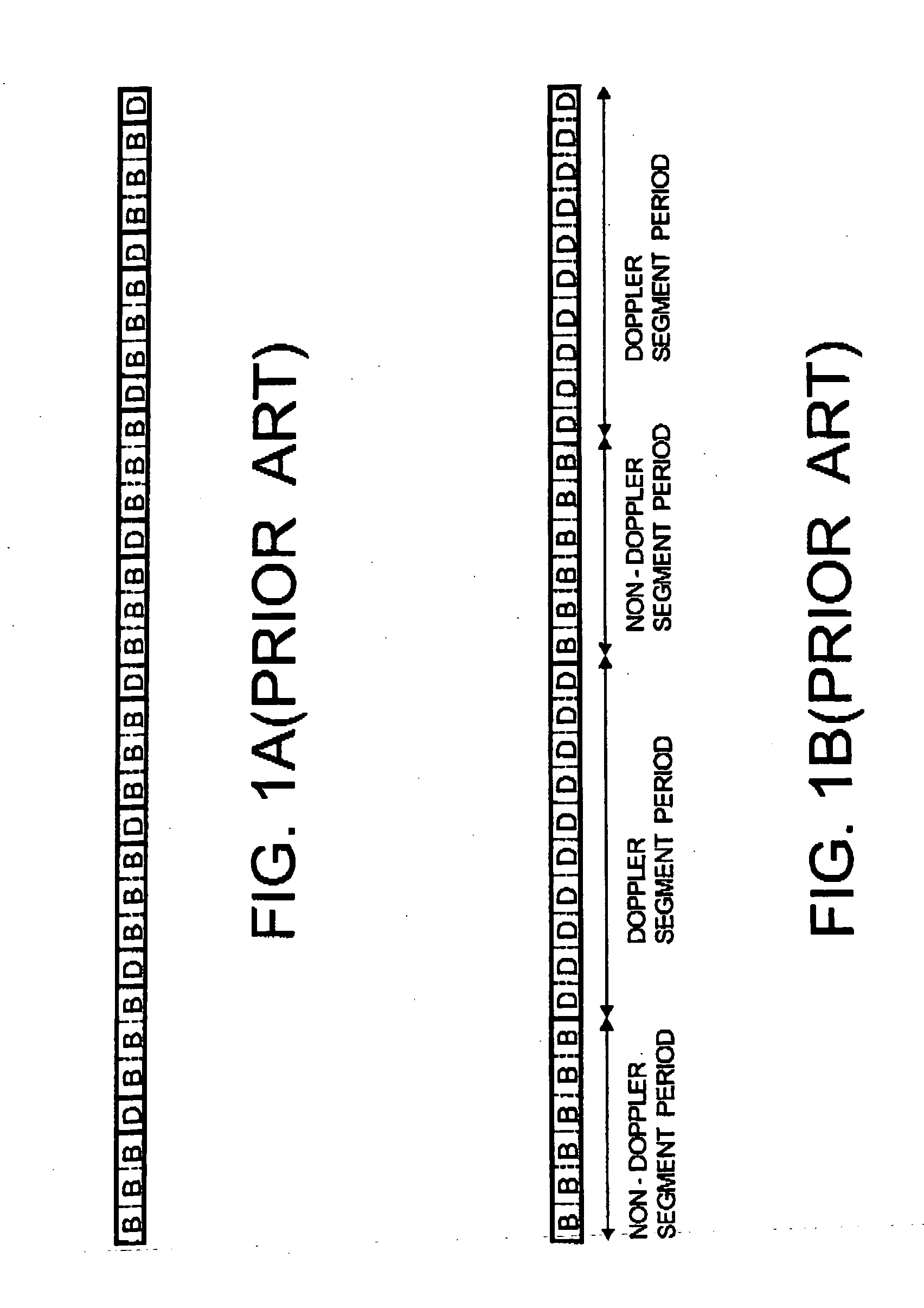 Ultrasound diagnosis apparatus