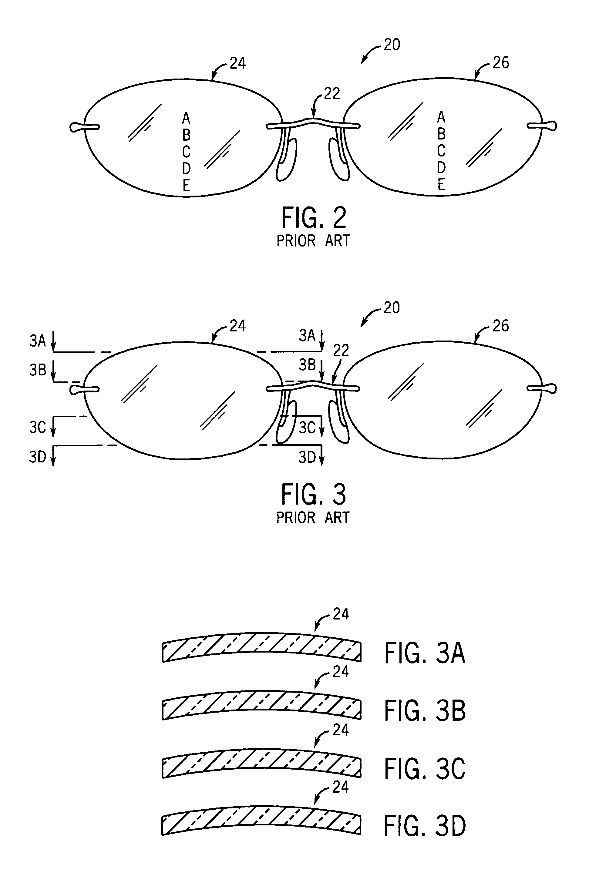 Multi-focal ophthalmic lens with base in prism