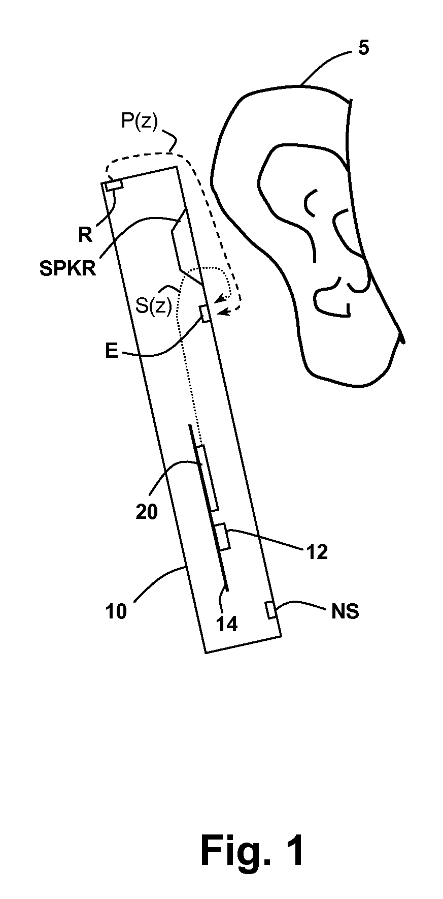 Oversight control of an adaptive noise canceler in a personal audio device