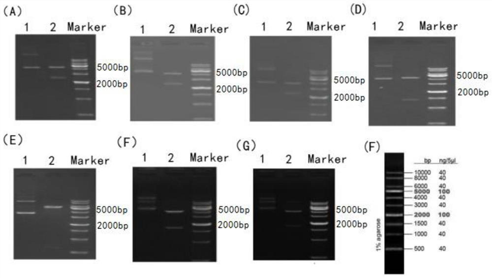 Human agrin antigen, human agrin antibody detection kit, preparation method and application thereof