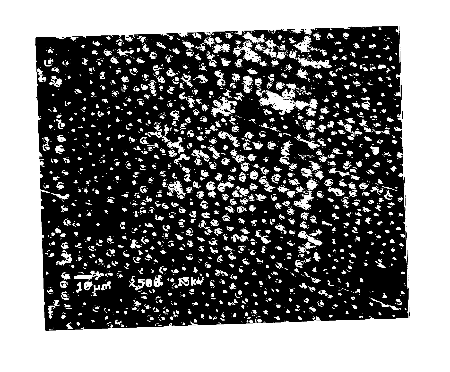 Method of etching and priming a tooth