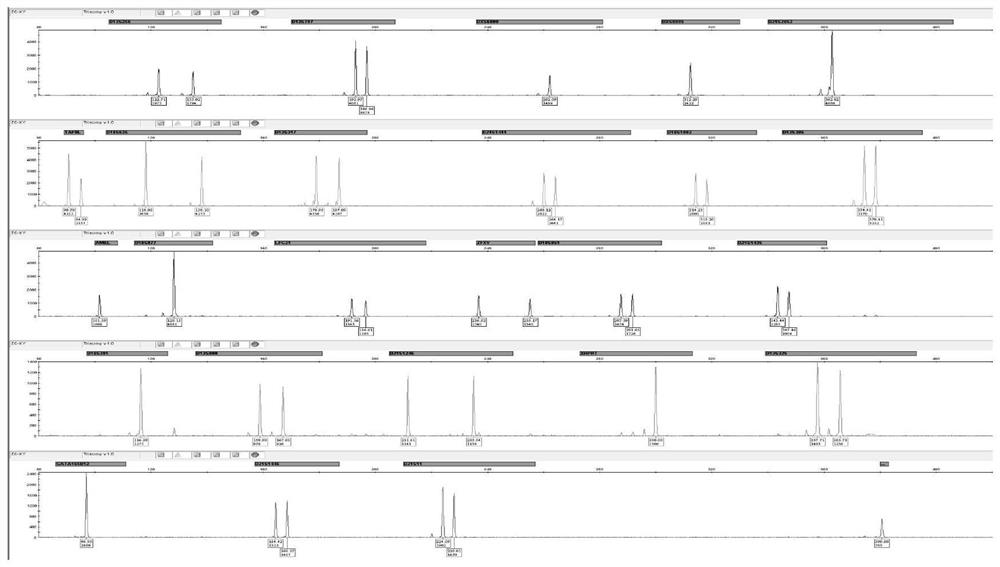 Amplification composition for chromosome aneuploid number abnormality and application thereof