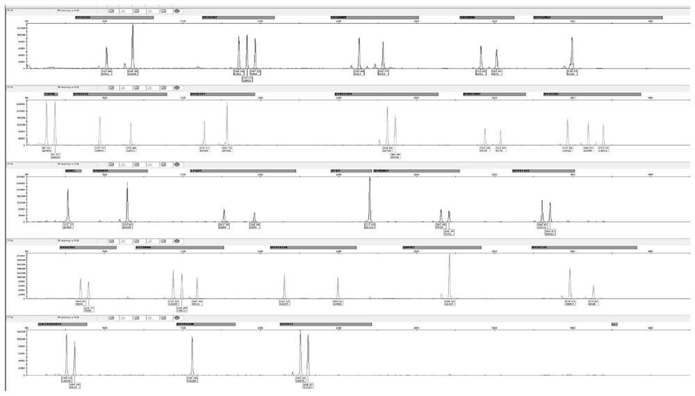 Amplification composition for chromosome aneuploid number abnormality and application thereof