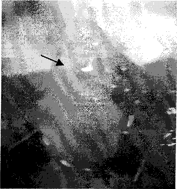 Tissue engineered bone-cartilage complex tissue graft and preparation method thereof