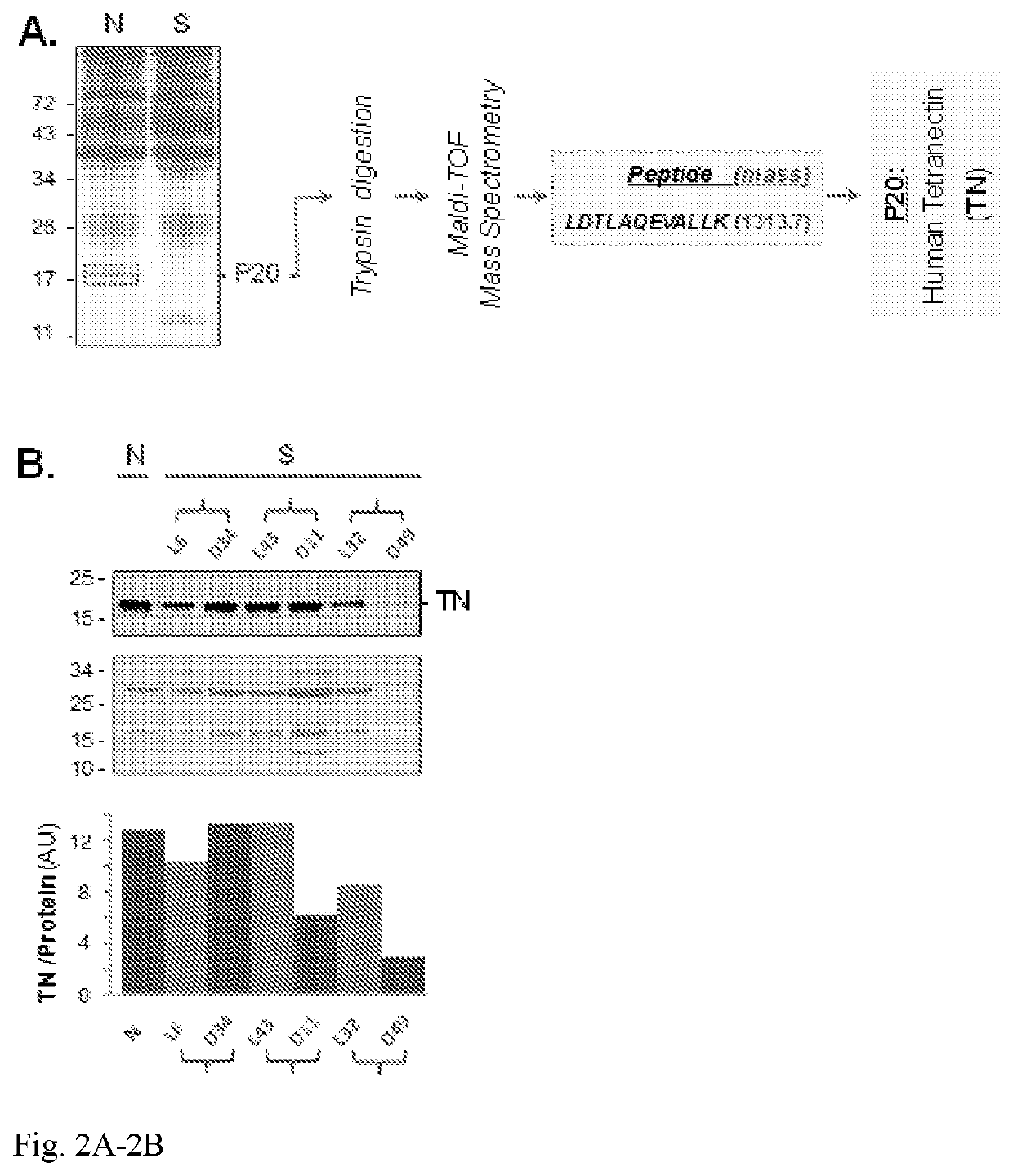 Use of tetranectin and peptide agonists to treat inflammatory diseases