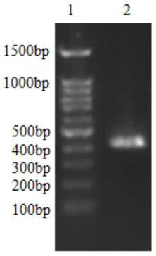 Single domain antibody and its coding gene, immunotoxin and its coding gene, preparation method, expression vector, application, and host cell