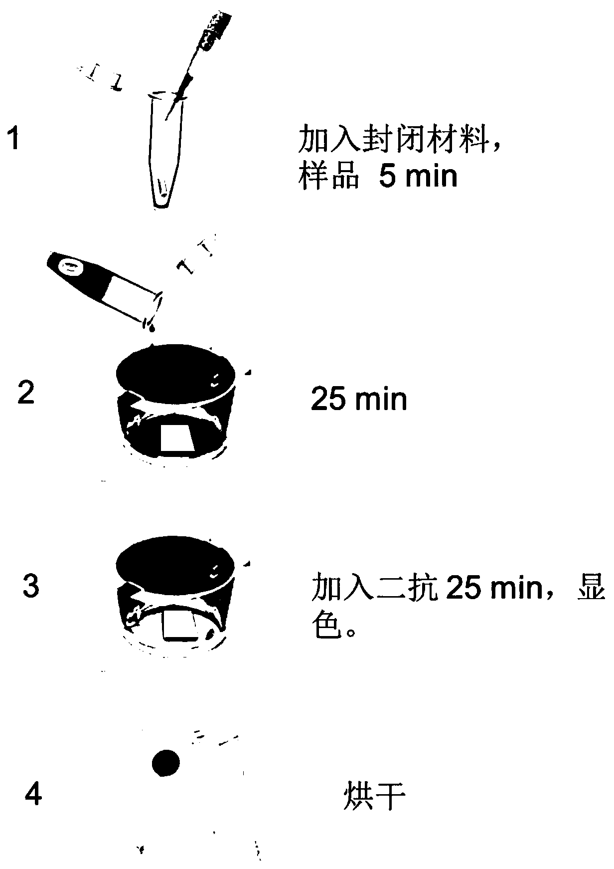 Detection material for anti-leucine-rich glioma inactivated 1 (LGI1) autoantibody in human body fluid and preparation method and application of detection material