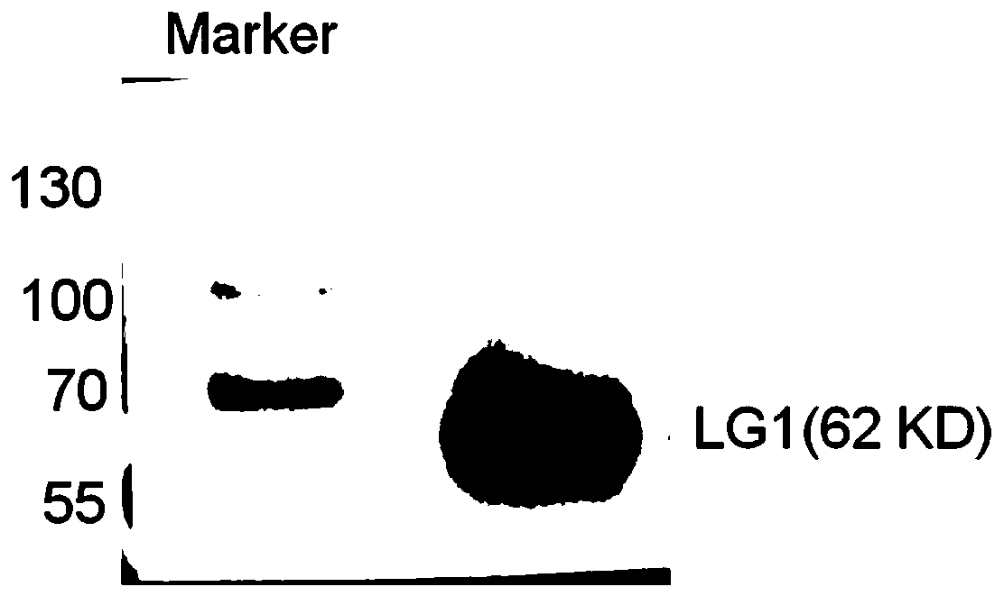 Detection material for anti-leucine-rich glioma inactivated 1 (LGI1) autoantibody in human body fluid and preparation method and application of detection material