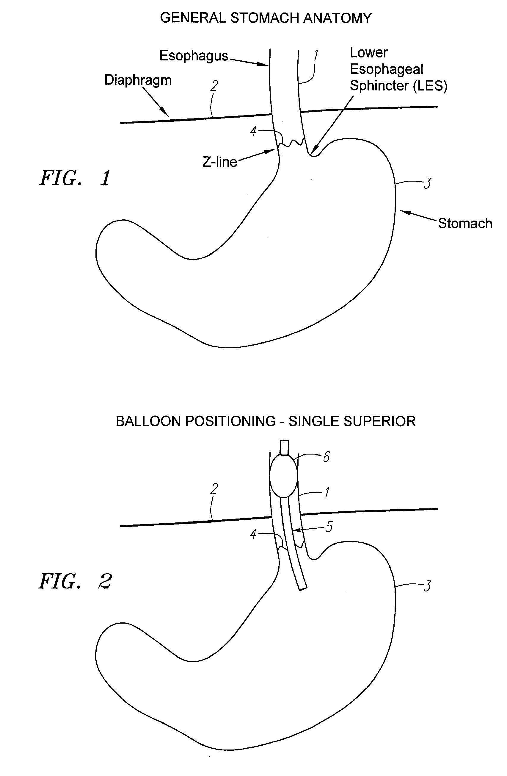 Methods and Apparatus for Testing Disruption of a Vagal Nerve