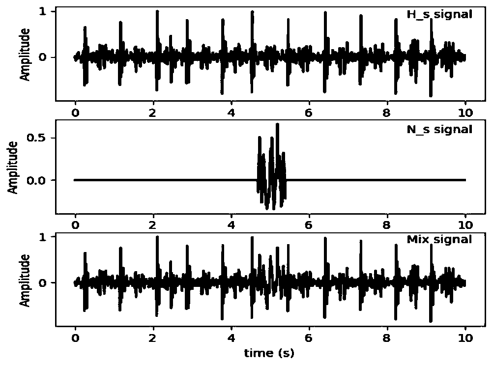 Method for eliminating friction noise of electronic stethoscope