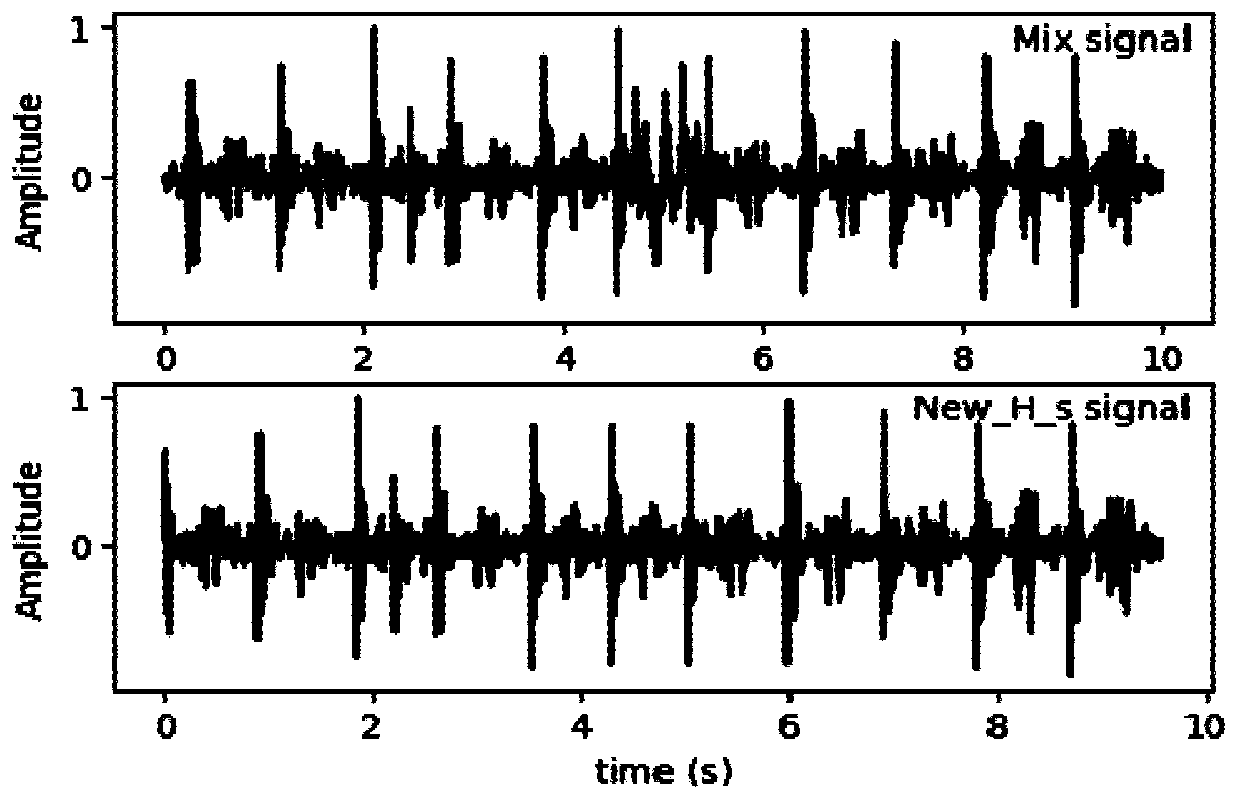 Method for eliminating friction noise of electronic stethoscope