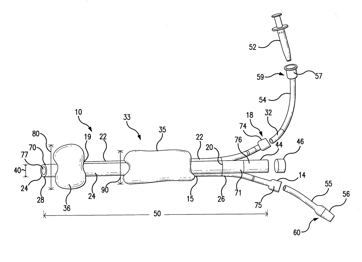 Colostomy balloon plug