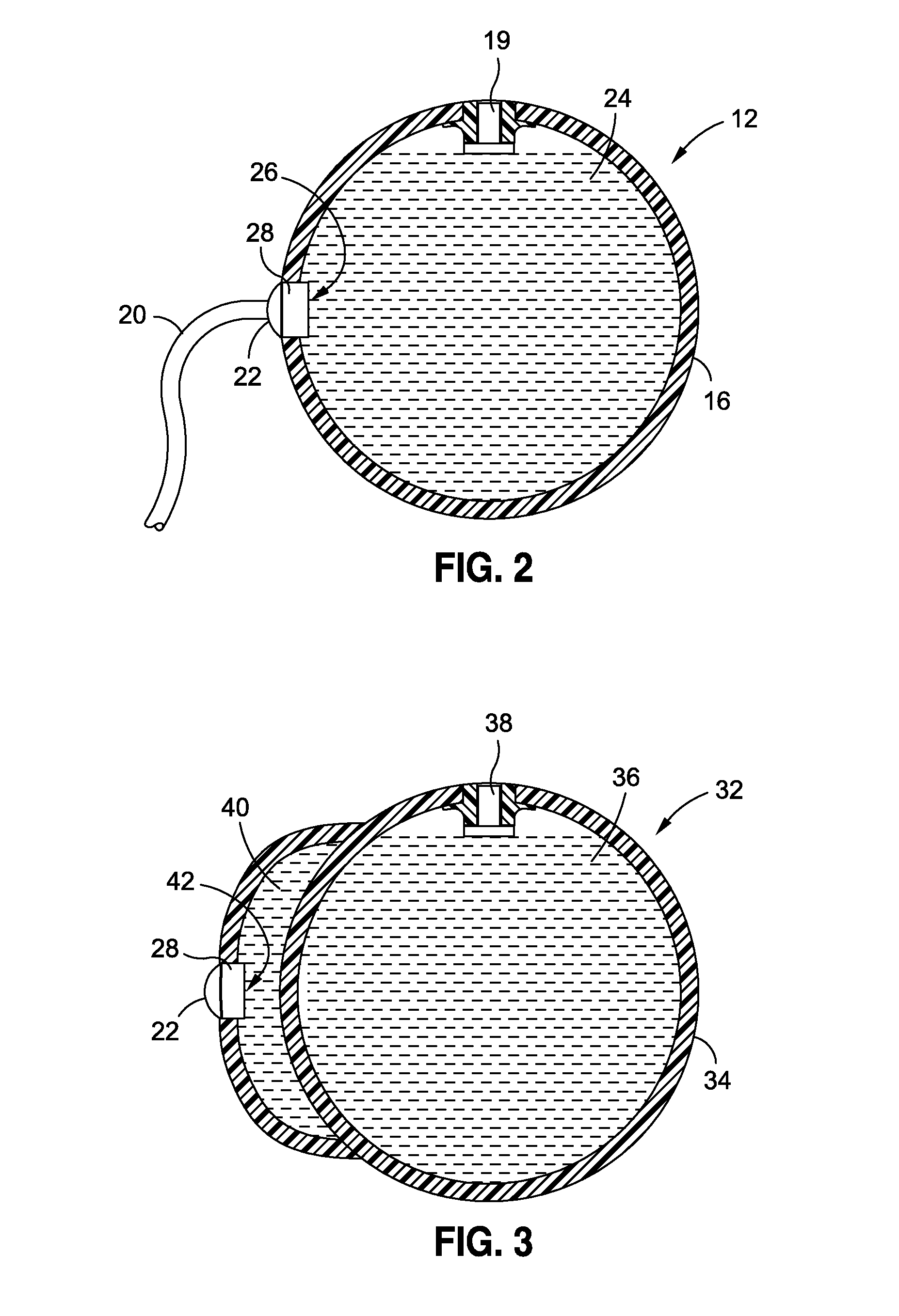 Intragastric Volume Occupying Device with Active Agents