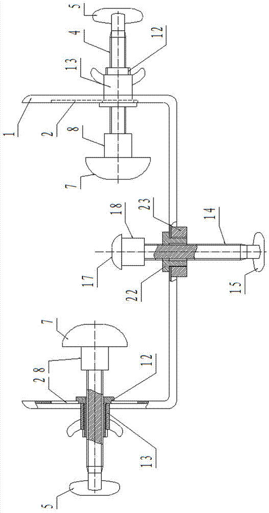 Calcaneal fracture closed compression reduction device