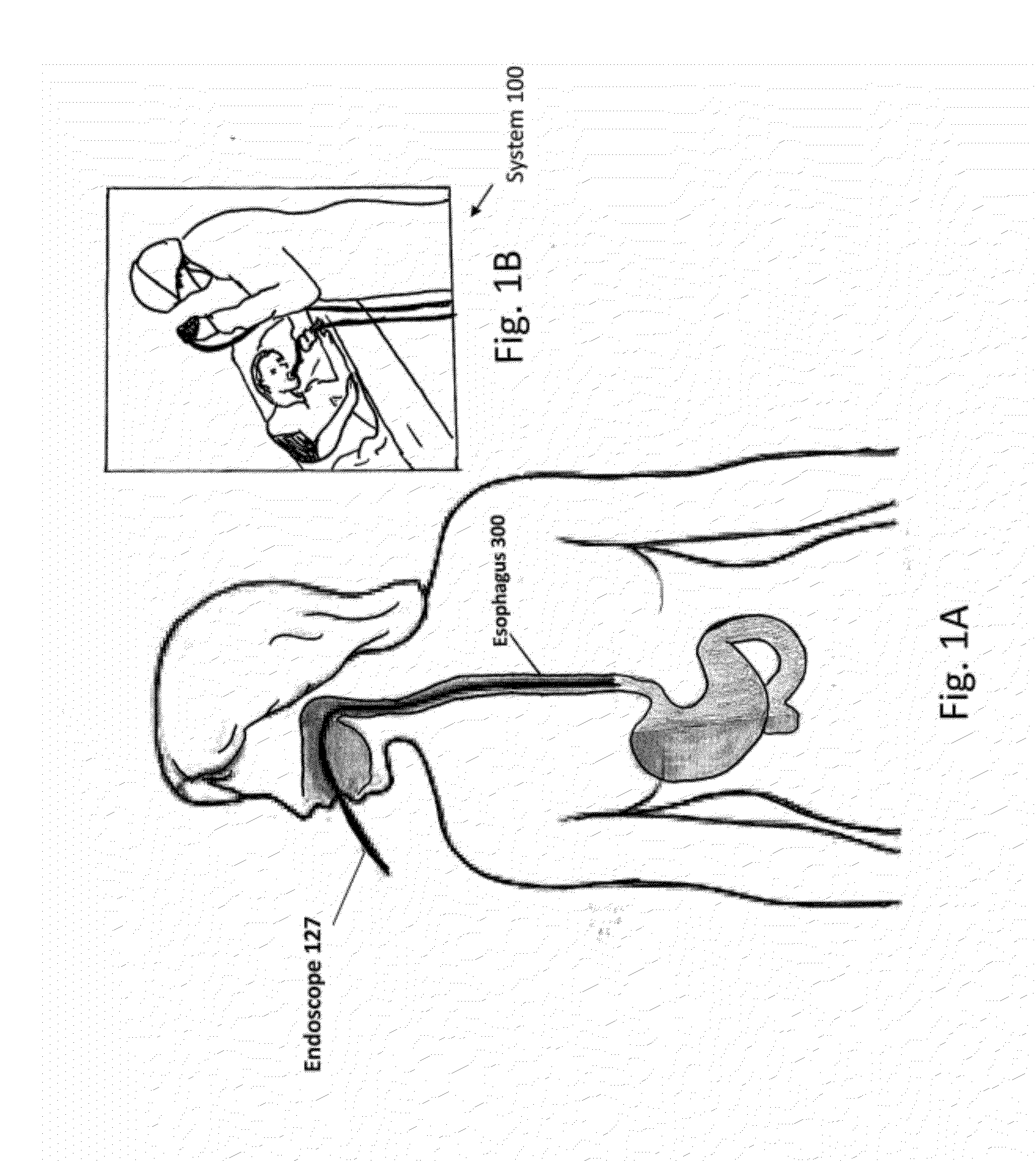 Diode laser systems and methods for endoscopic treatment of tissue