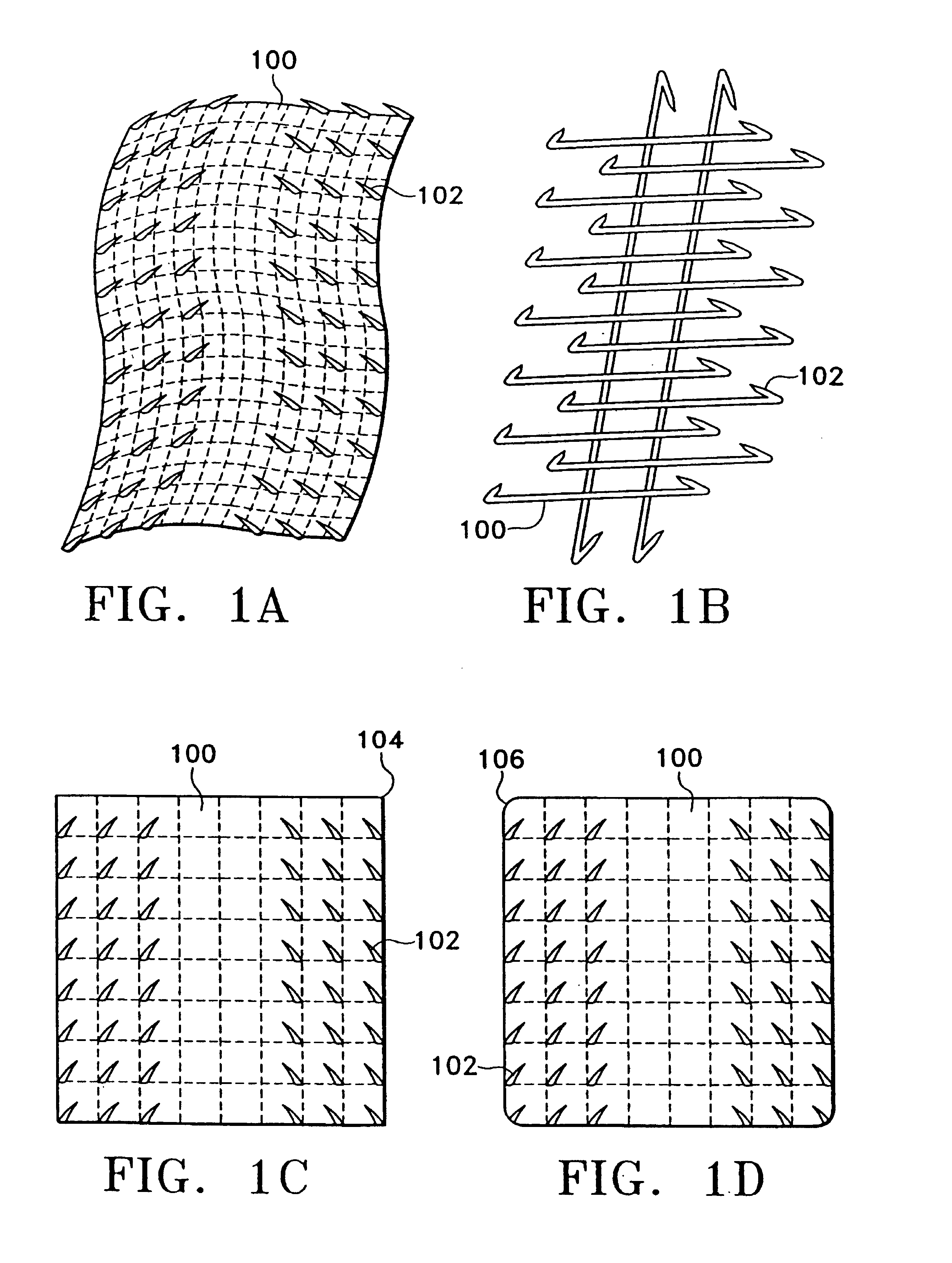 Multi-point tension distribution system device and method of tissue approximation using that device to improve wound healing