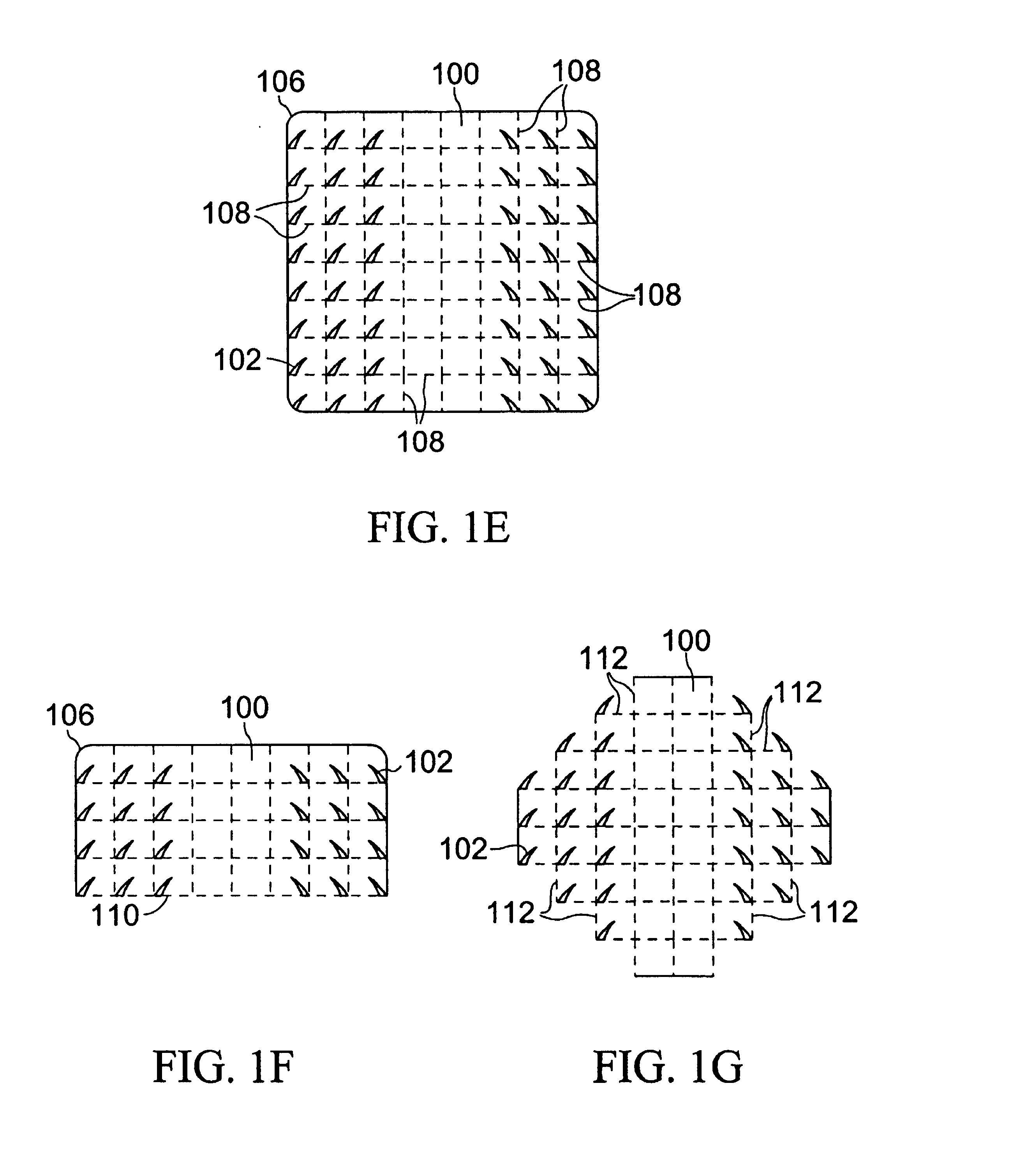 Multi-point tension distribution system device and method of tissue approximation using that device to improve wound healing