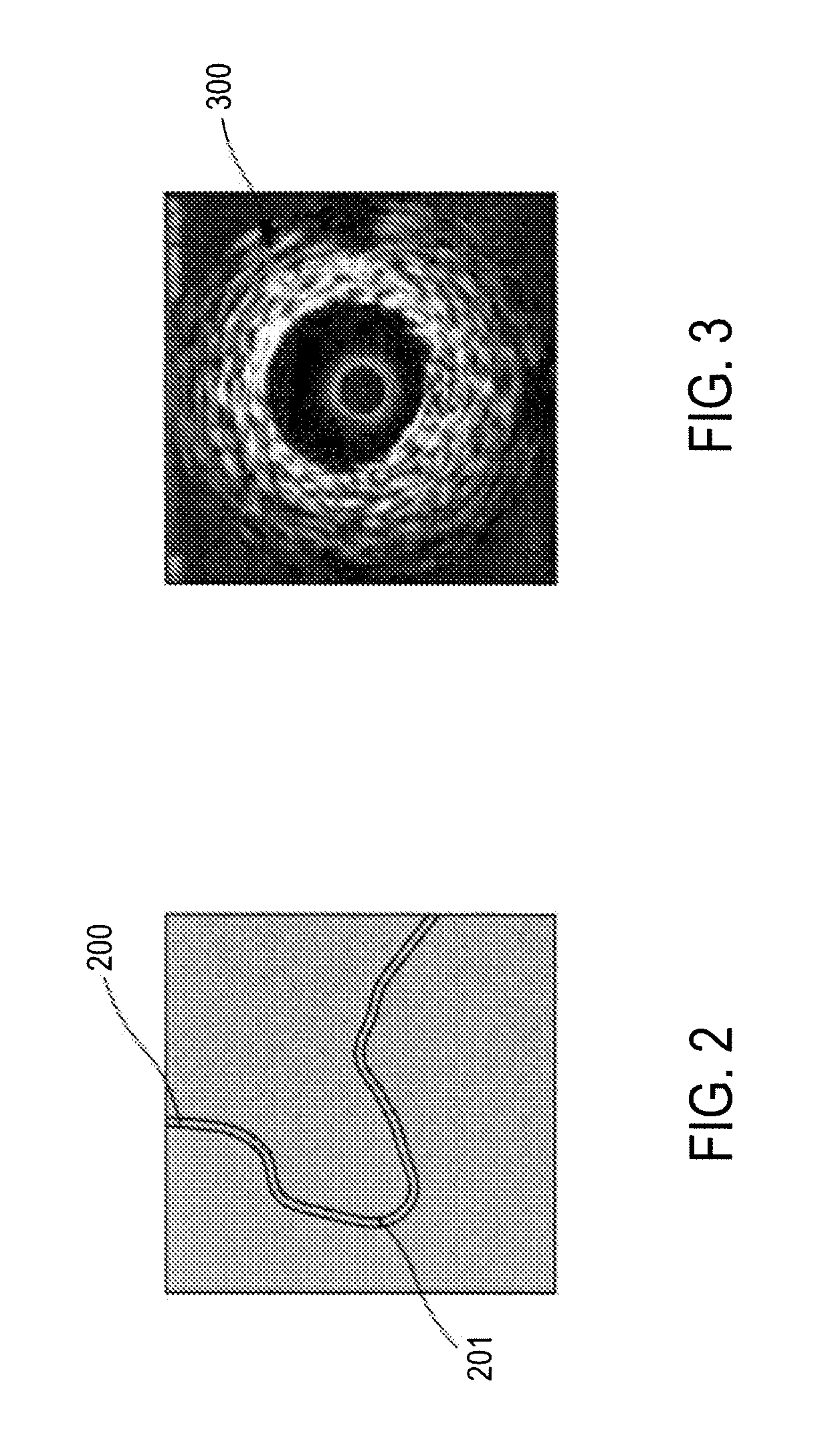 Synchronization of medical imaging systems