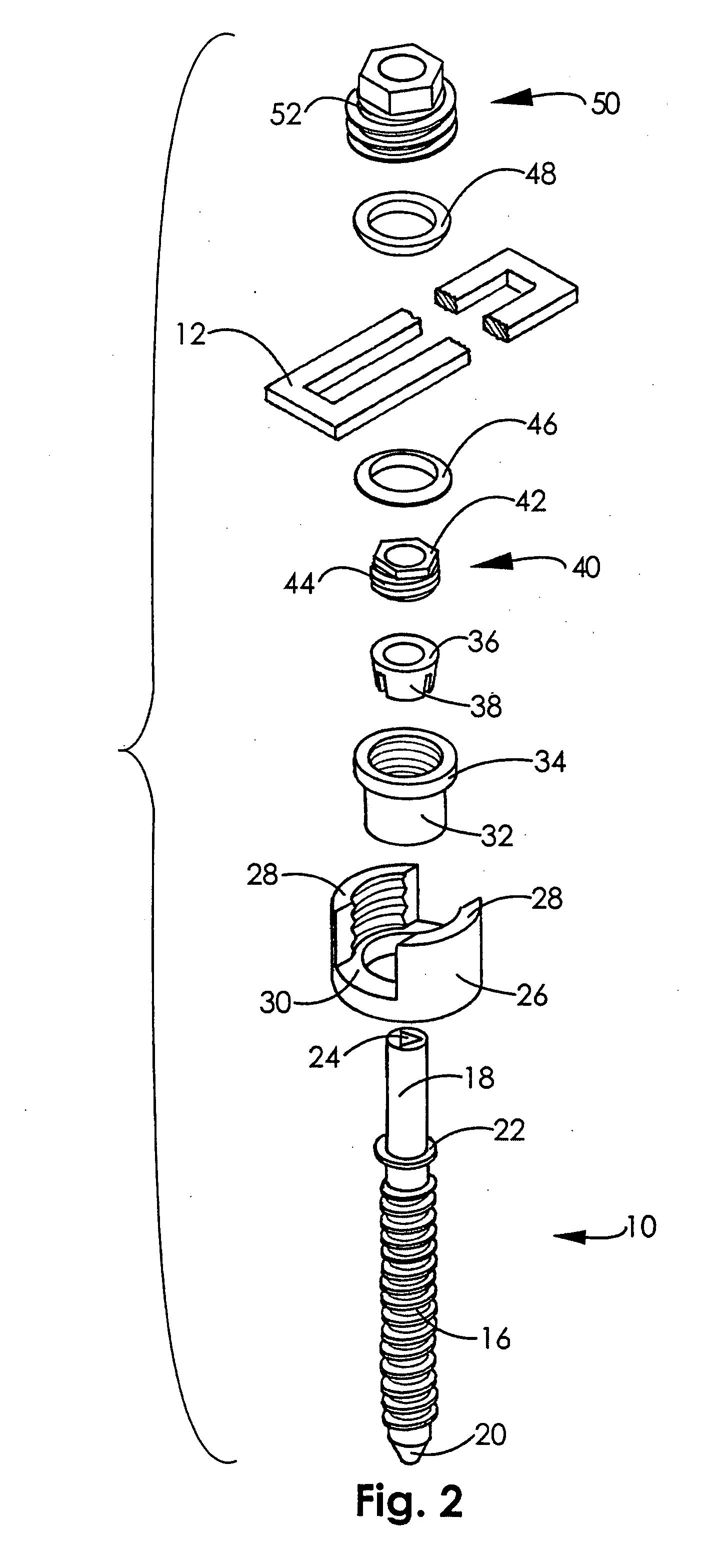 Spinal fixation system