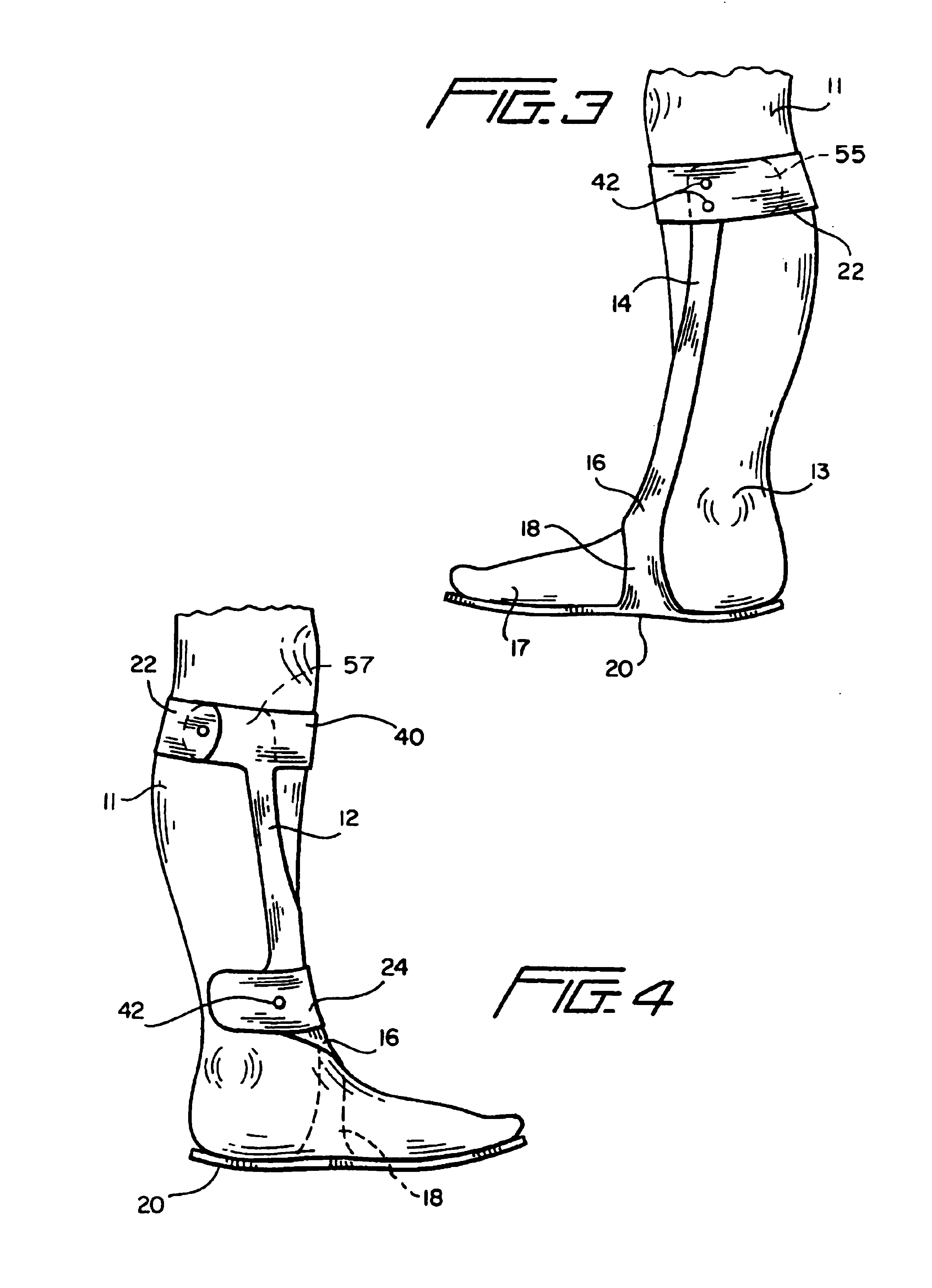 Ankle-foot orthosis