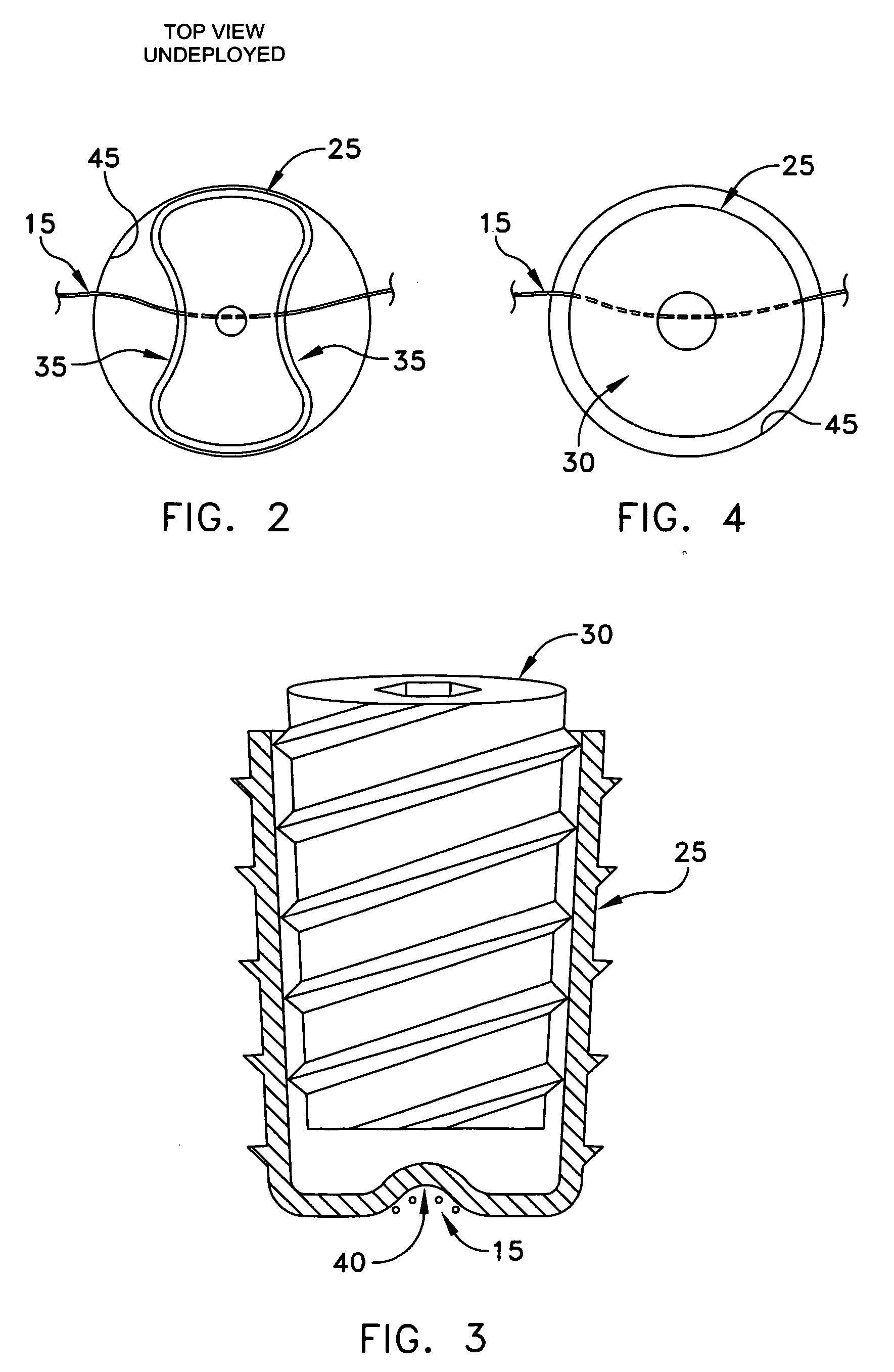 Knotless suture anchor