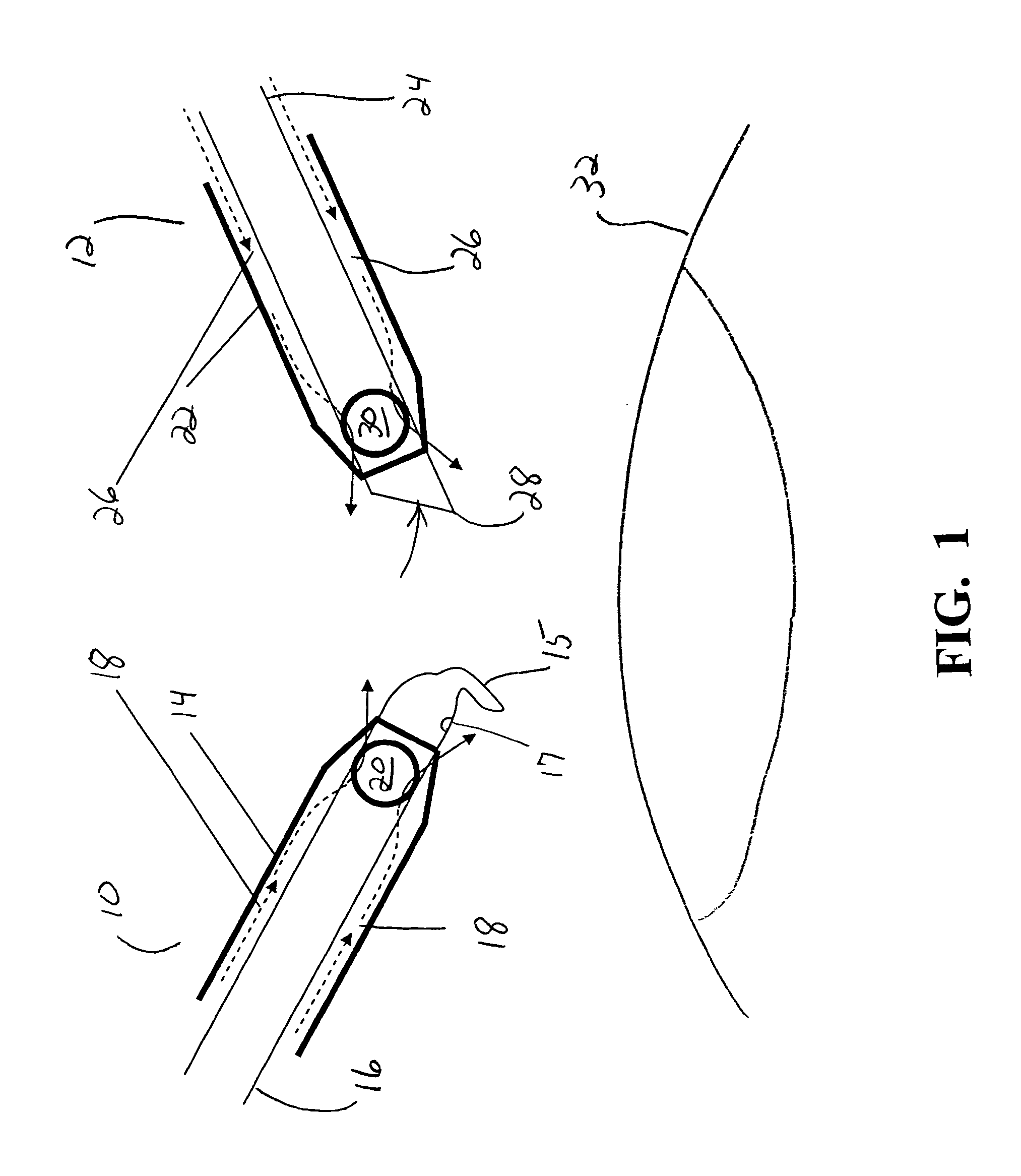 Surgical method and apparatus