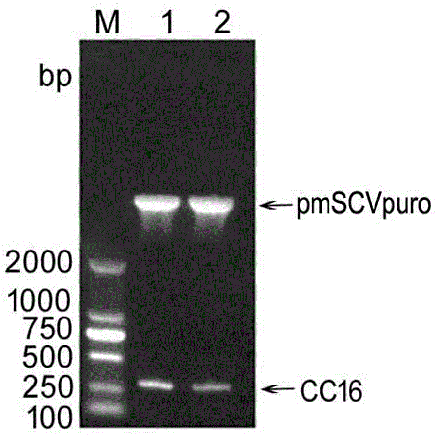 Recombinant human CC16 gene, construction of eukaryotic expression vector of CC16 gene, and purification of recombinant protein