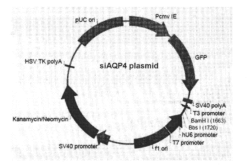 Aquaporin 4-siRNA interfering sequence, its fusion expression vectors and medicinal use of the fusion expression vectors