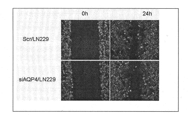 Aquaporin 4-siRNA interfering sequence, its fusion expression vectors and medicinal use of the fusion expression vectors