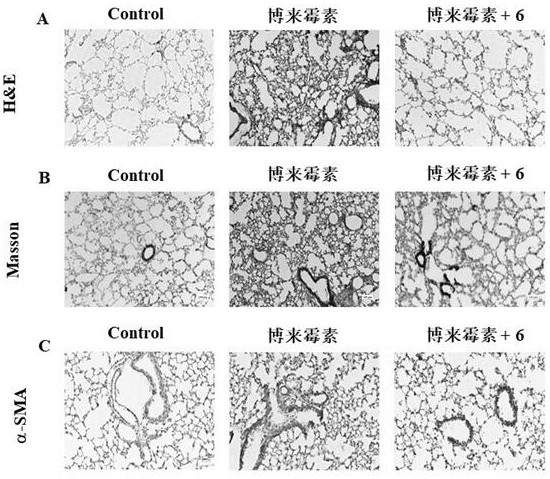 Medical application of cathepsin inhibitor