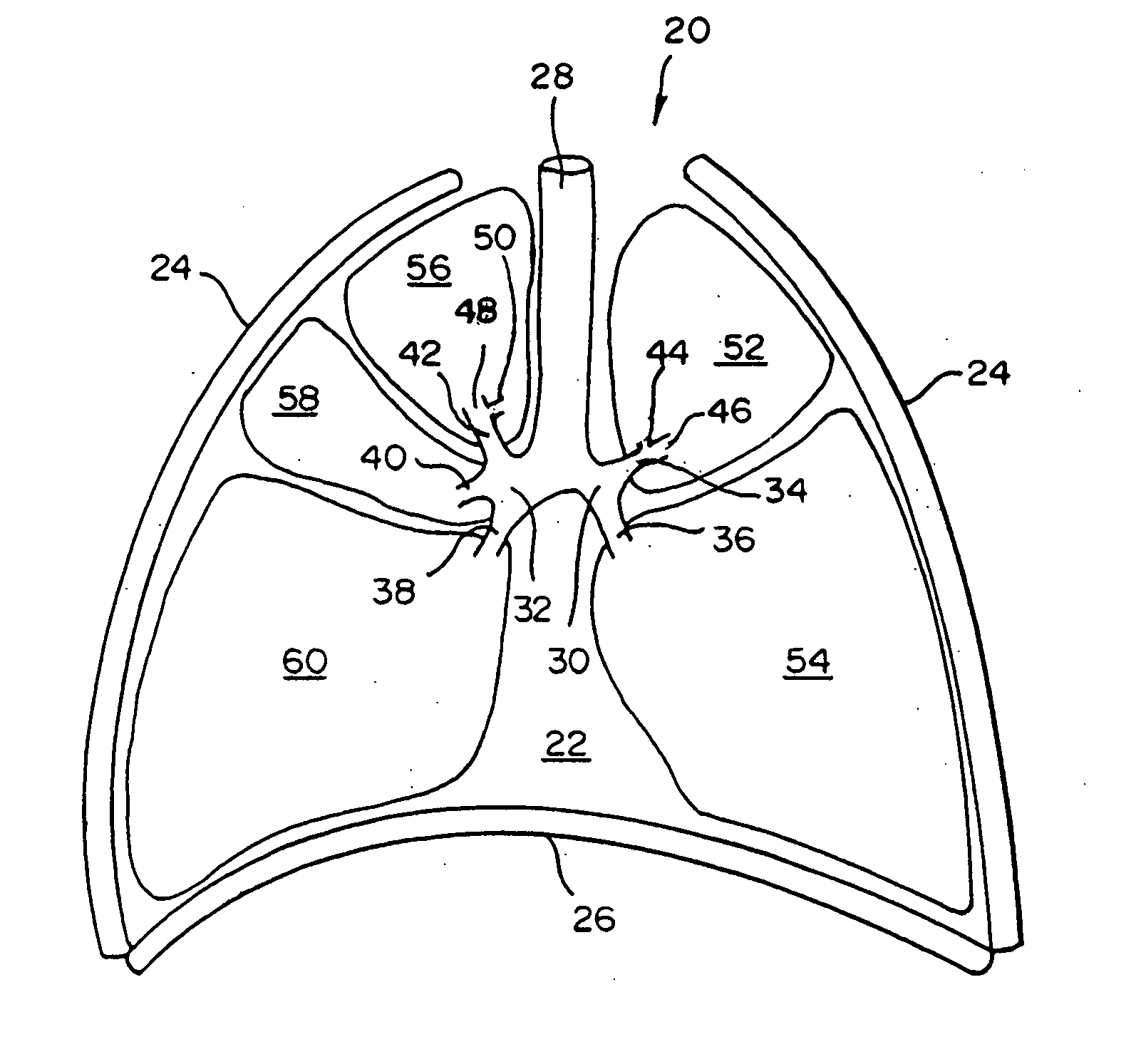 Intra-bronchial valve devices