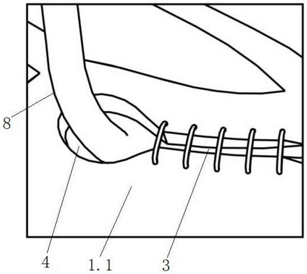 Implantable flexible magnetic control bladder extrusion device