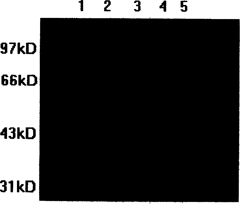 Aids recombination gland virus vaccine