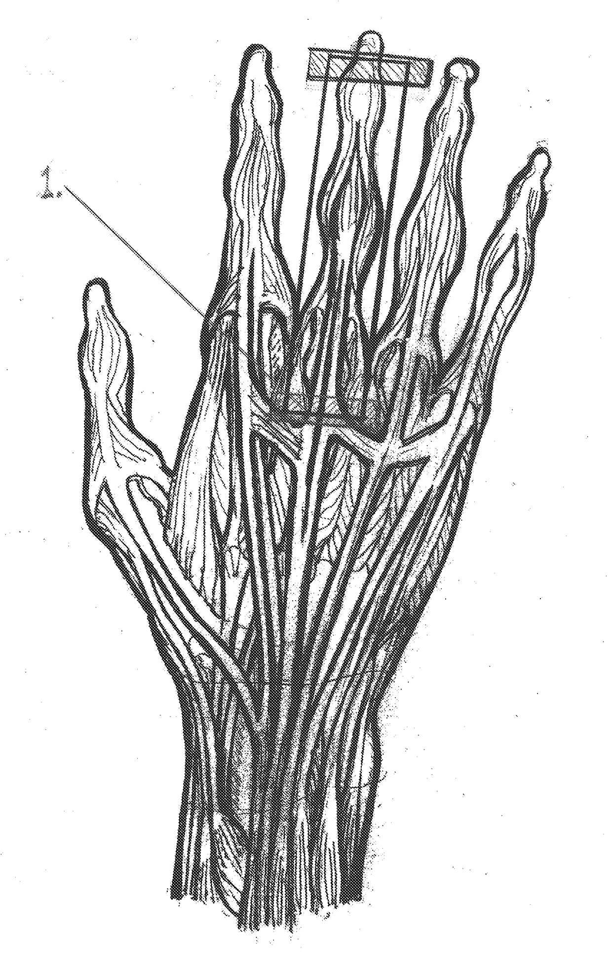 Dynamic Taping Method for Inhibition and Elicitation of Skeletal Muscle Tone