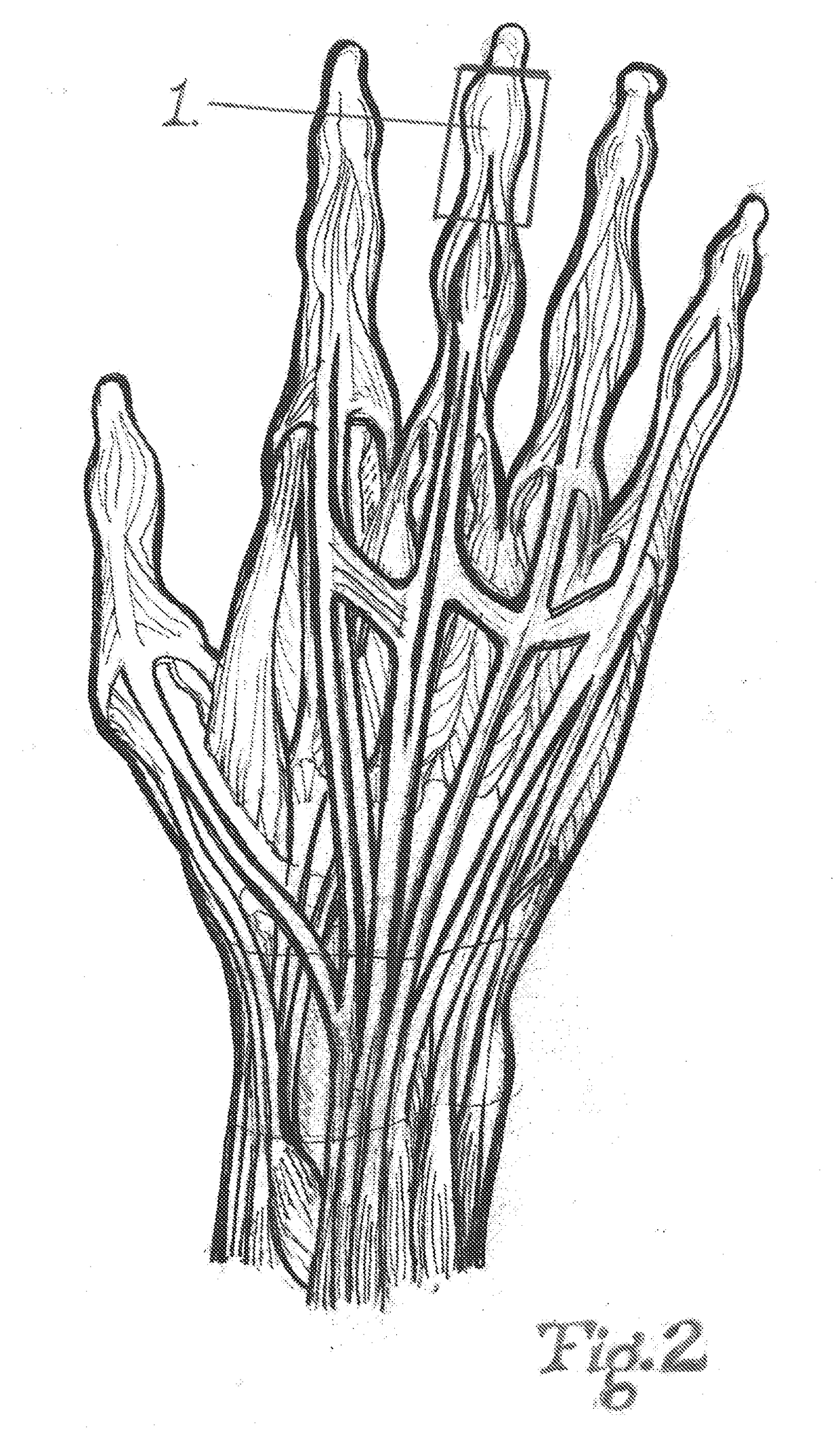 Dynamic Taping Method for Inhibition and Elicitation of Skeletal Muscle Tone