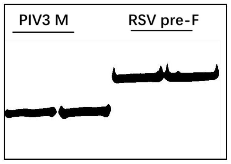 A recombinant vector for improving the solubility of viral glycoprotein and its preparation method and application